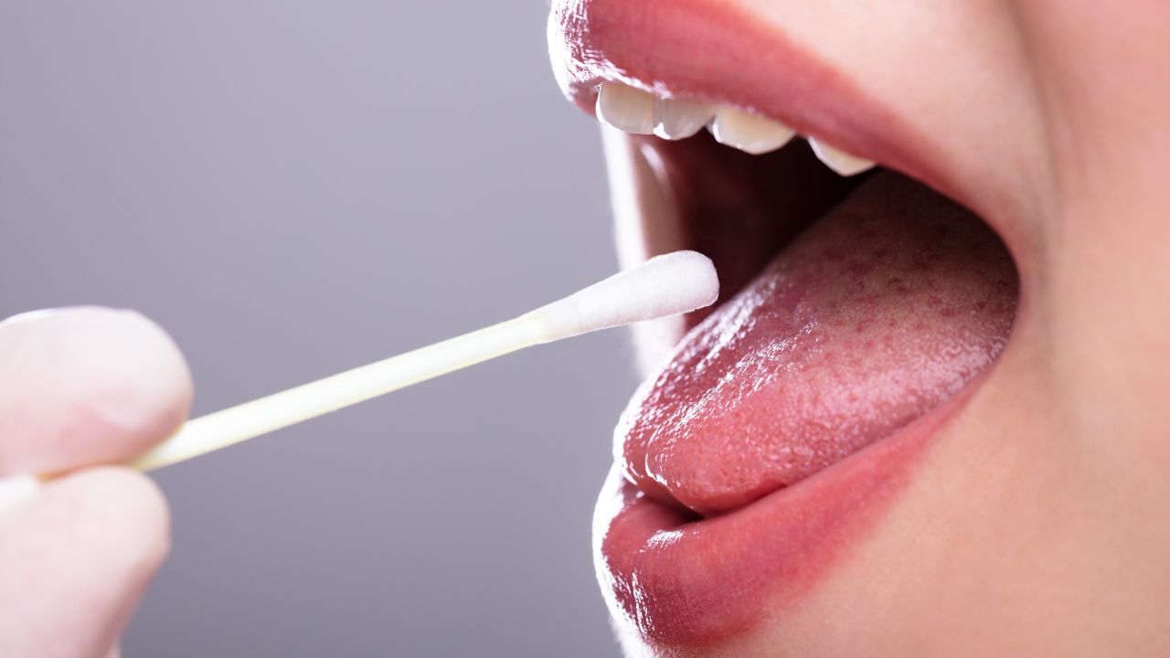 5 enfermedades que se transmiten por la saliva